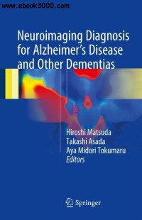 Neuroimaging  Diagnosis for Alzheimers Disease and Other Dementias